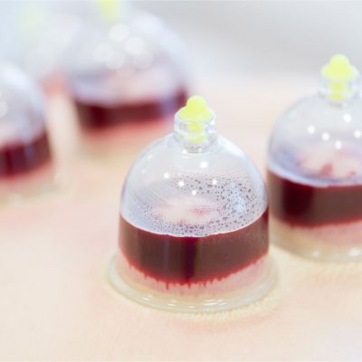 Blood Letting Cupping
